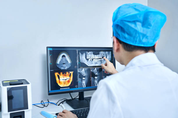 Best Emergency Wisdom Teeth Removal in Urbana, MD